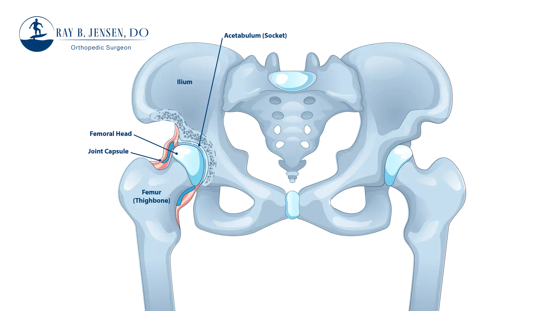 Anatomical Graphic of the Hips Anatomy